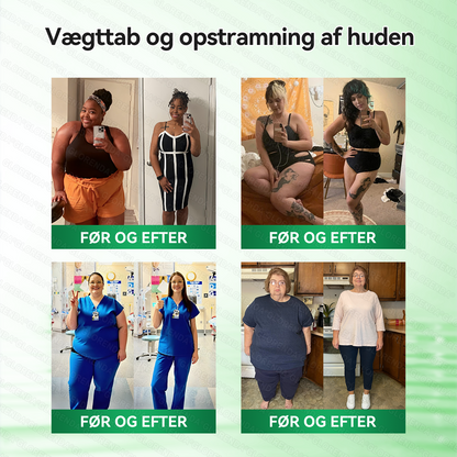 🔥 Kun 10 æsker tilbage! 30% ekstra rabat. GLORENDA® Moringa · Berberin × NAD+ Advanced 10-i-1-komponent: sikker, testet og effektiv til vægt, glukose, fordøjelse og energi.